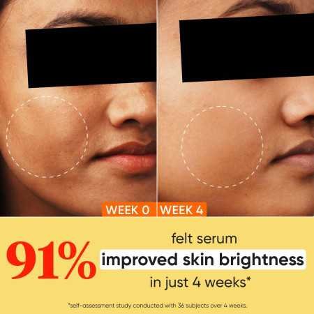 Dot & Key 10% Vitamin C + E, 5% Niacinamide Serum | Vitamin C Serum For Glowing Skin | Fades Dark Spots | Vit C Serum with Blood