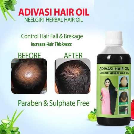 Adivasi Herbal Hair Growth Oil | Controls Hairfall | Strong and Healthy Hair | Repairs Frizzy Hair Nourishment - 100ml (PACK OF