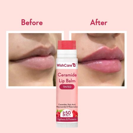 WishCare Tinted Ceramide Lip Balm with SPF50 PA+++ - Kojic Acid & Niacinamide - For Lip Lightening & Protection 5gm