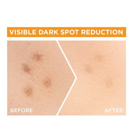 Garnier Skin Naturals, Bright Complete 30X Vitamin C Booster Face Serum, Increases Skin's Glow Instantly and Reduces Spots Garnier Skin Naturals, Bright Complete 30X Vitamin C Booster Face Serum, Increases Skin's Glow Instantly and Reduces Spots