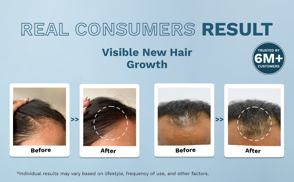 Advanced-Hair-Growth-Serum